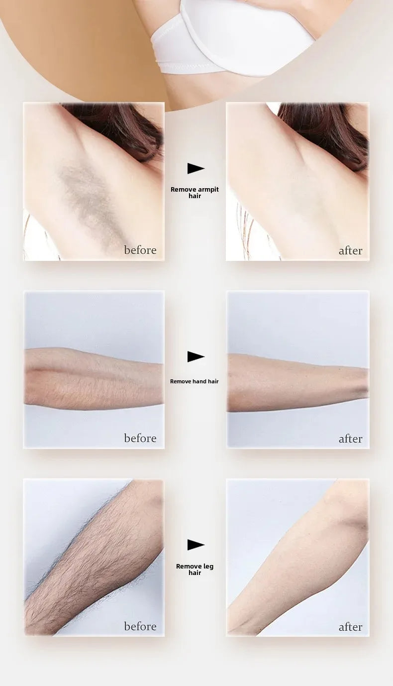 LumiSmooth™ 4 en 1 ✨ – Belleza sin vello, piel de ensueño 💖