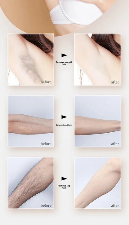 LumiSmooth™ 4 en 1 ✨ – Belleza sin vello, piel de ensueño 💖